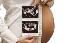 Un 4% de los niños nace en Euskadi mediante técnicas de reproducción asistida./ Fotolia