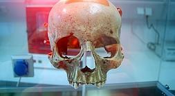 Al compositor le falta la mandíbula.