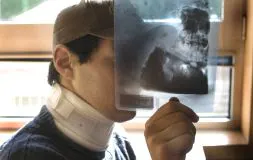 HERIDAS. La víctima de la golpiza enseña su collarín y una radiografía de la boca. / BERNARDO CORRAL
