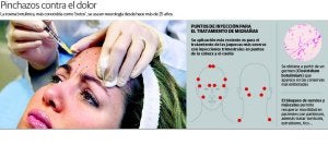 Inyecciones de botox contra la migraña