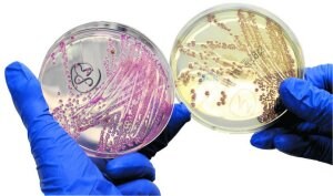 Nueva cepa. Muestras de la bacteria que se investiga en el laboratorio de la Clínica Universitaria de Hamburgo. ::
EFE