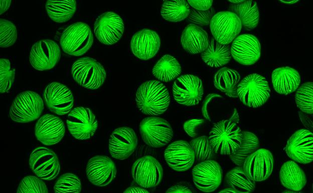 Polen de espatifilo, al microscopio.