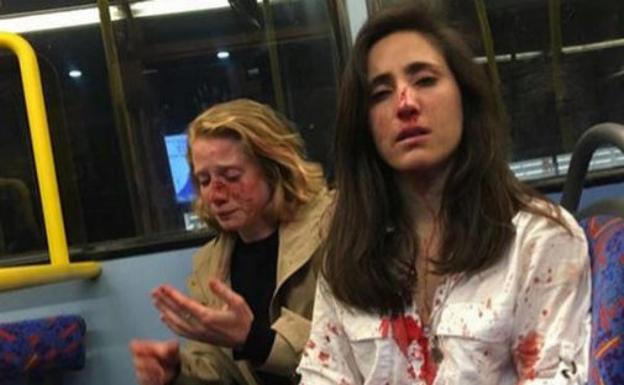 Imagen subida a las redes sociales por Melania Geymonat de ella y su novia, tras la agresión sufrida en un autobús de Londres.