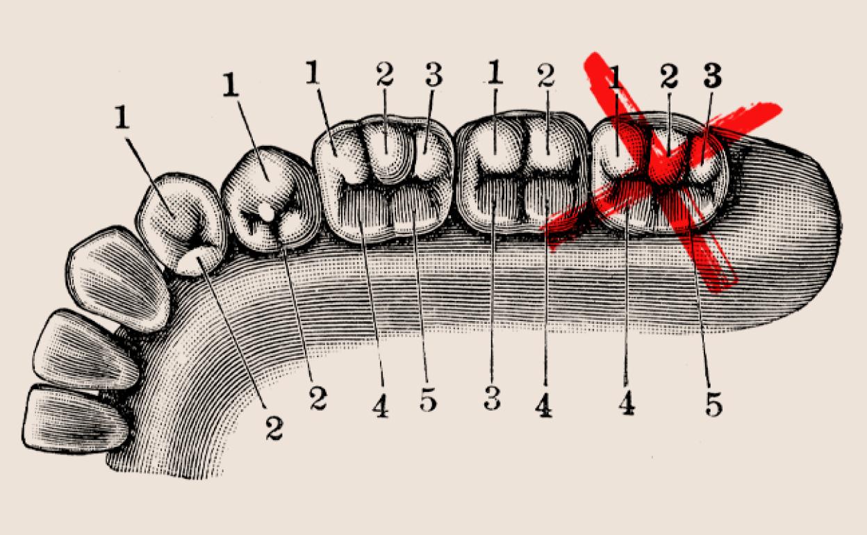 ¿Para qué sirven las muelas del juicio si nos las suelen quitar?