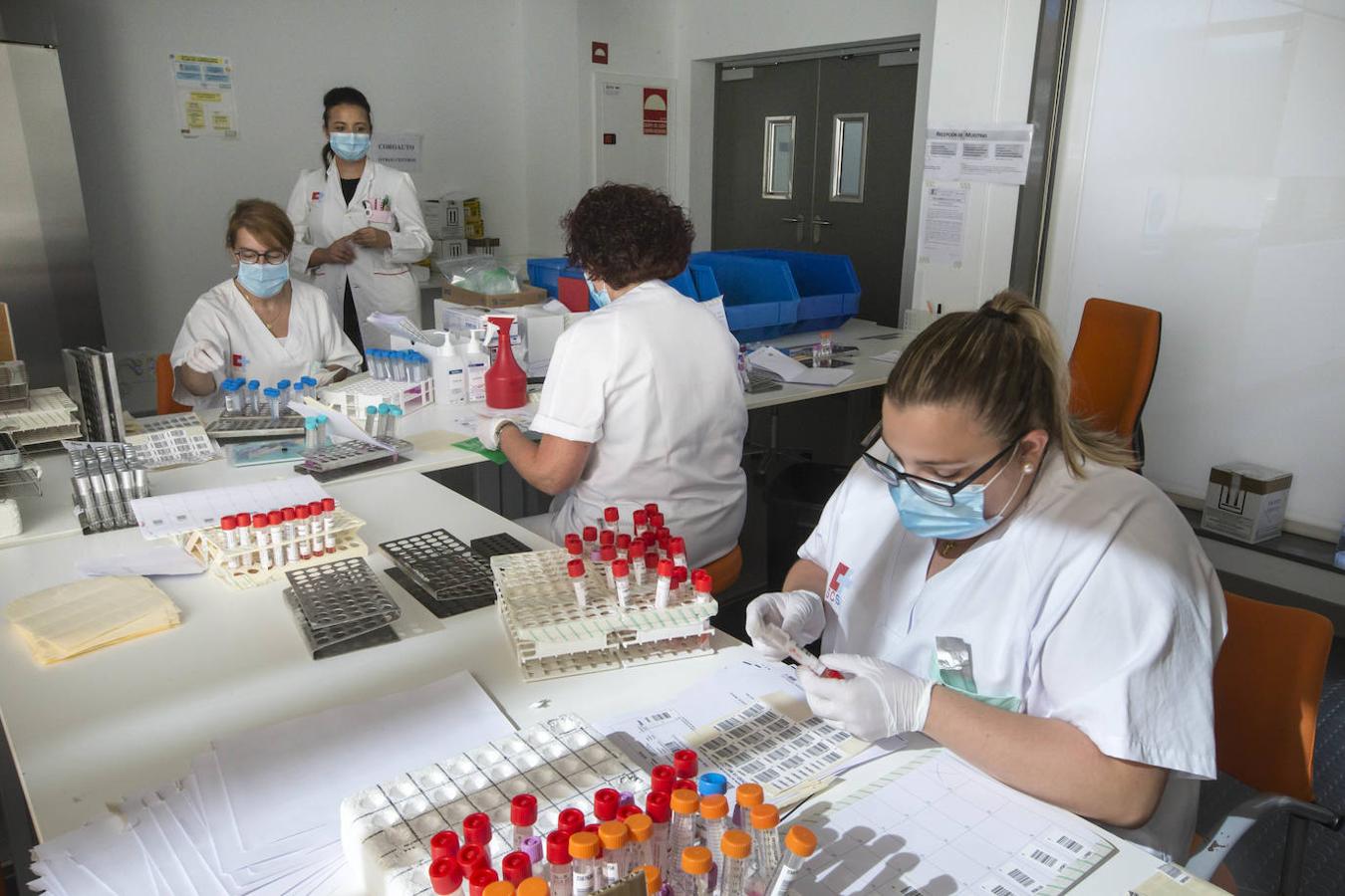 El laboratorio de Microbiología realiza más de 1.500 PCR diarias en busca del patógeno, oculto en un 6% de las pruebas.