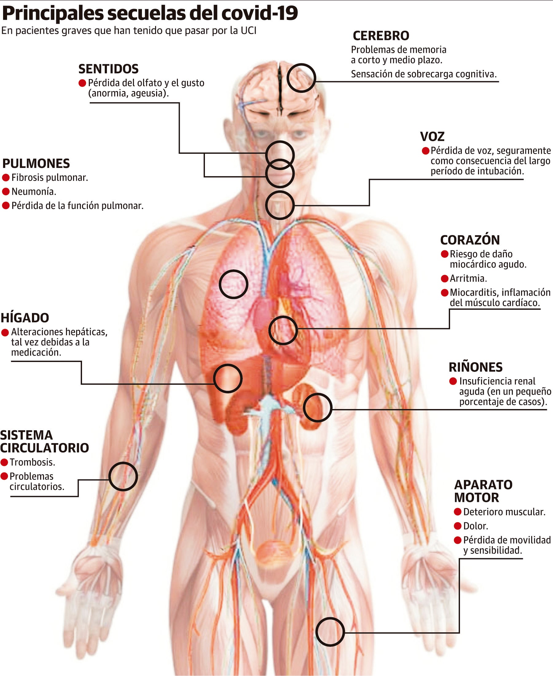 Principales secuelas que deja en covid en pacientes que han pasado por la UCI