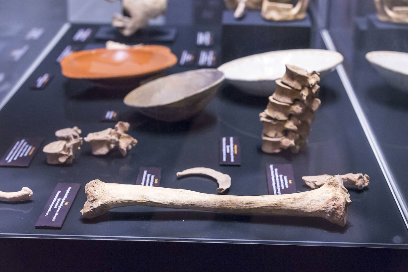 El Museo de Prehistoria y Arqueología de Cantabria (MUPAC) acoge hasta final de año una exposición que muestra cómo los restos humanos sirven para conocer la historia de la región a través de la información que aportan sobre cómo vivieron y murieron las personas.