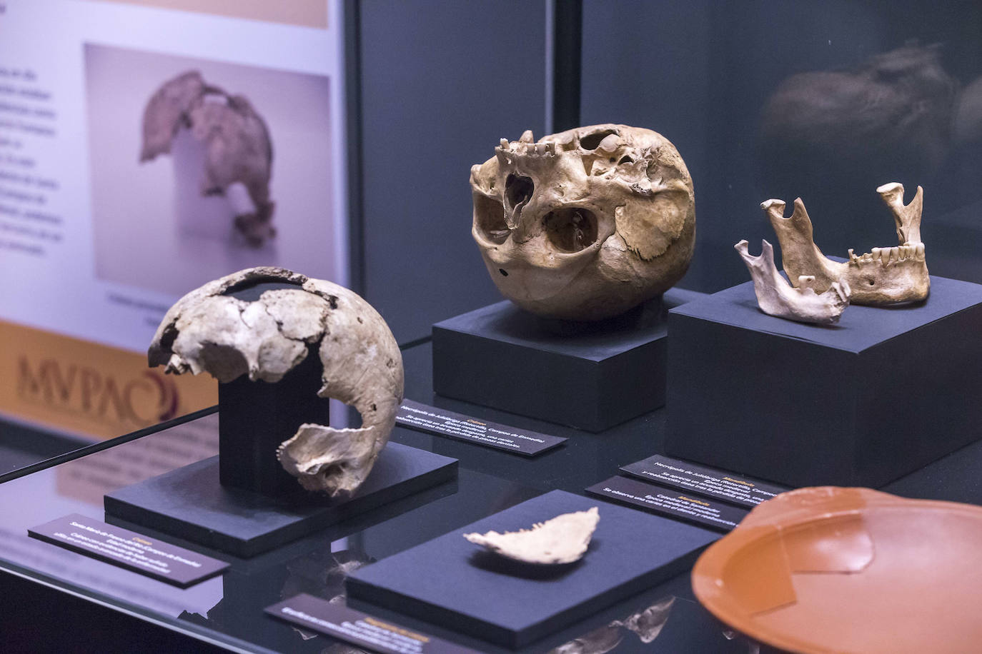 El Museo de Prehistoria y Arqueología de Cantabria (MUPAC) acoge hasta final de año una exposición que muestra cómo los restos humanos sirven para conocer la historia de la región a través de la información que aportan sobre cómo vivieron y murieron las personas.