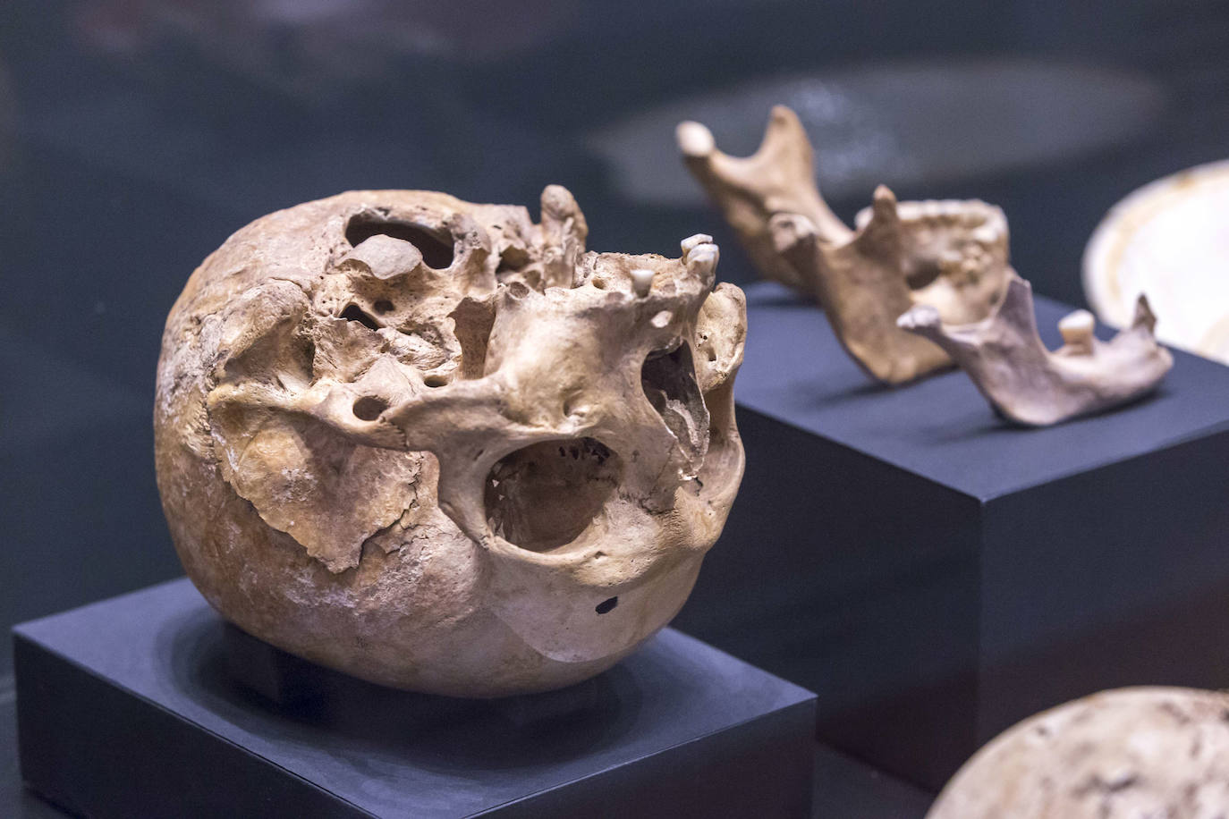 El Museo de Prehistoria y Arqueología de Cantabria (MUPAC) acoge hasta final de año una exposición que muestra cómo los restos humanos sirven para conocer la historia de la región a través de la información que aportan sobre cómo vivieron y murieron las personas.