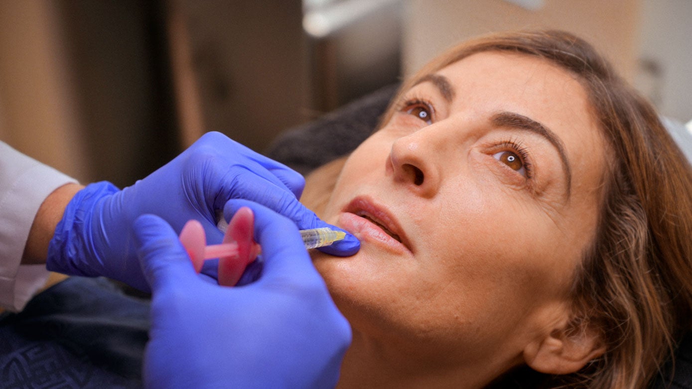 Momento en el que el doctor aplica el ácido hialurónico en los labios, con una fina aguja. 