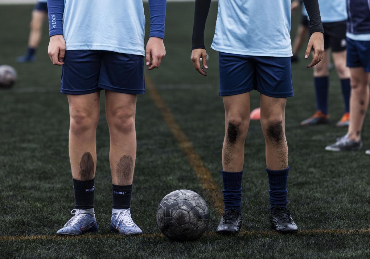 Imagen principal - Las piernas, manos y balones, llenos de caucho. 