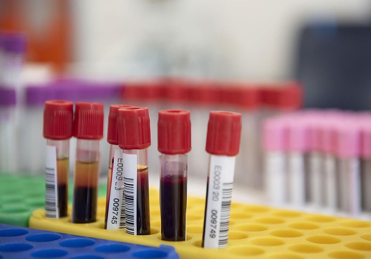 Donación de plasma en el Banco de Sangre y Tejidos de Cantabria.