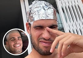 El antes y el después de la decoloración.