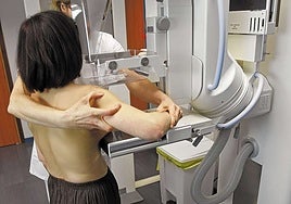 Una mujer se coloca en el mamógrafo para realizarse la prueba.