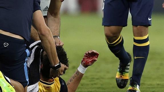 Mandzukic, operado con éxito de su fractura nasal