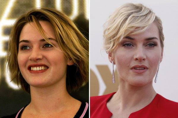 Kate Winslet, otra famosa que ha ganado con el cambio. Ella ha reconocido una ligera rinoplastia.