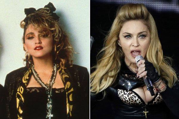 Madonna. Pópulos, labios, nariz, pechos... A sus 56 años, la reina del pop es también la reina del bisturí.