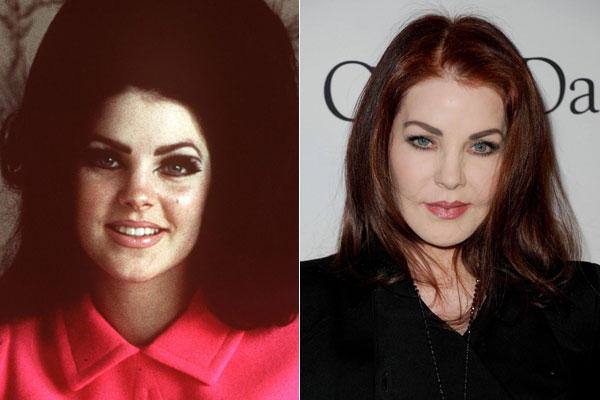 Priscilla Presley tiene en su haber una larga lista de operaciones: implante de pómulos, inyecciones de colageno, botox, levantamiento de cejas y rinoplastia.