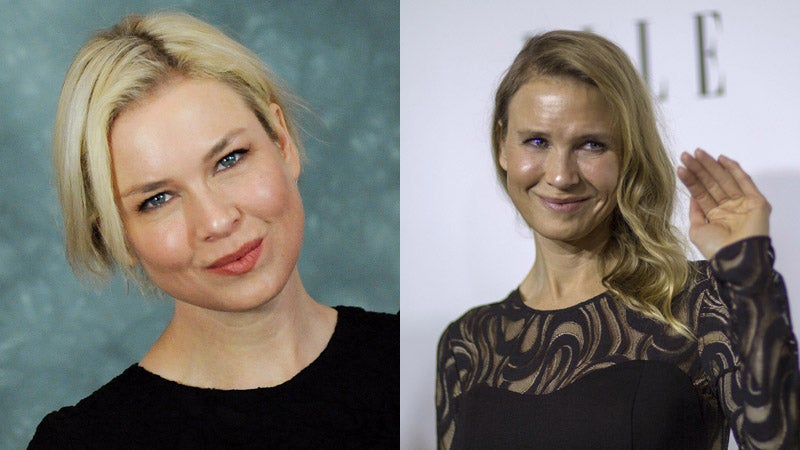 Renee Zellweger, aún reconocible en 2008, y con su nuevo rostro de 2014.