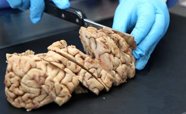 Un neuropatólogo, diseccionando un cerebro.