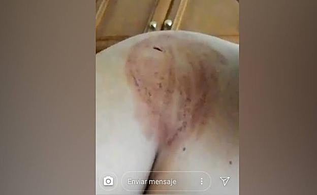 Imágenes de las heridas del menor sufridas por los tres navajazos. 