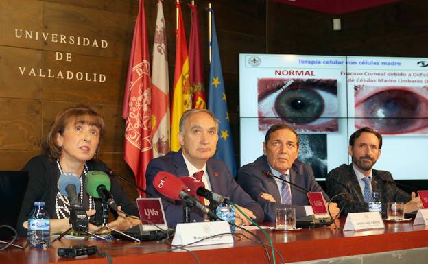 Presentación de una terapia celular desarrollada por el IOBA en colaboración con el IBGM para el tratamiento de un síndrome ocular. 