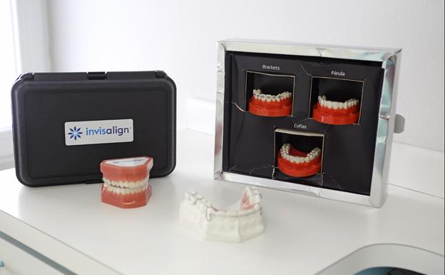 Carillas Invisalign.