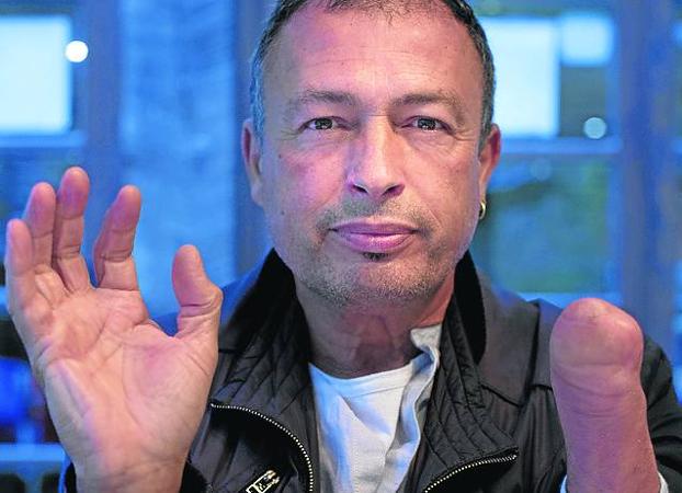 Ángel Cuadrado : «Me reconocen el defecto congénito pero no establecen el por qué»