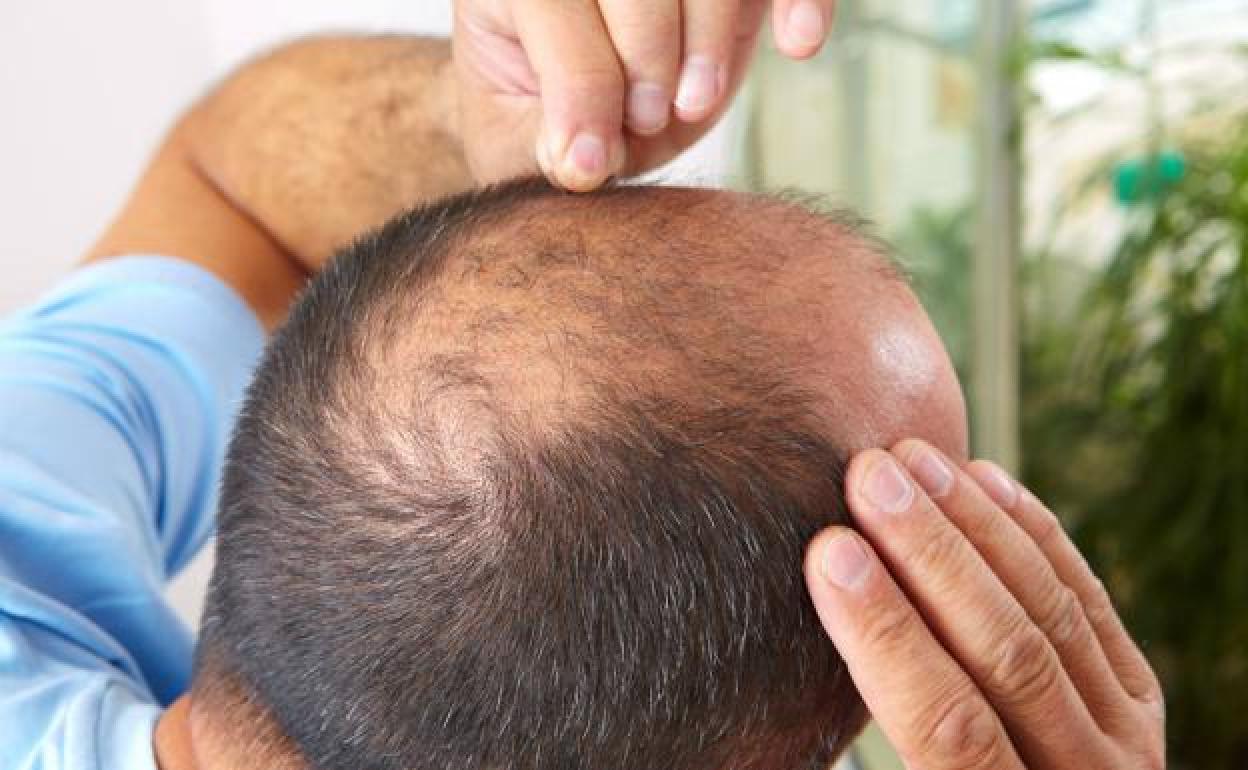 Una tarde en el calvólogo