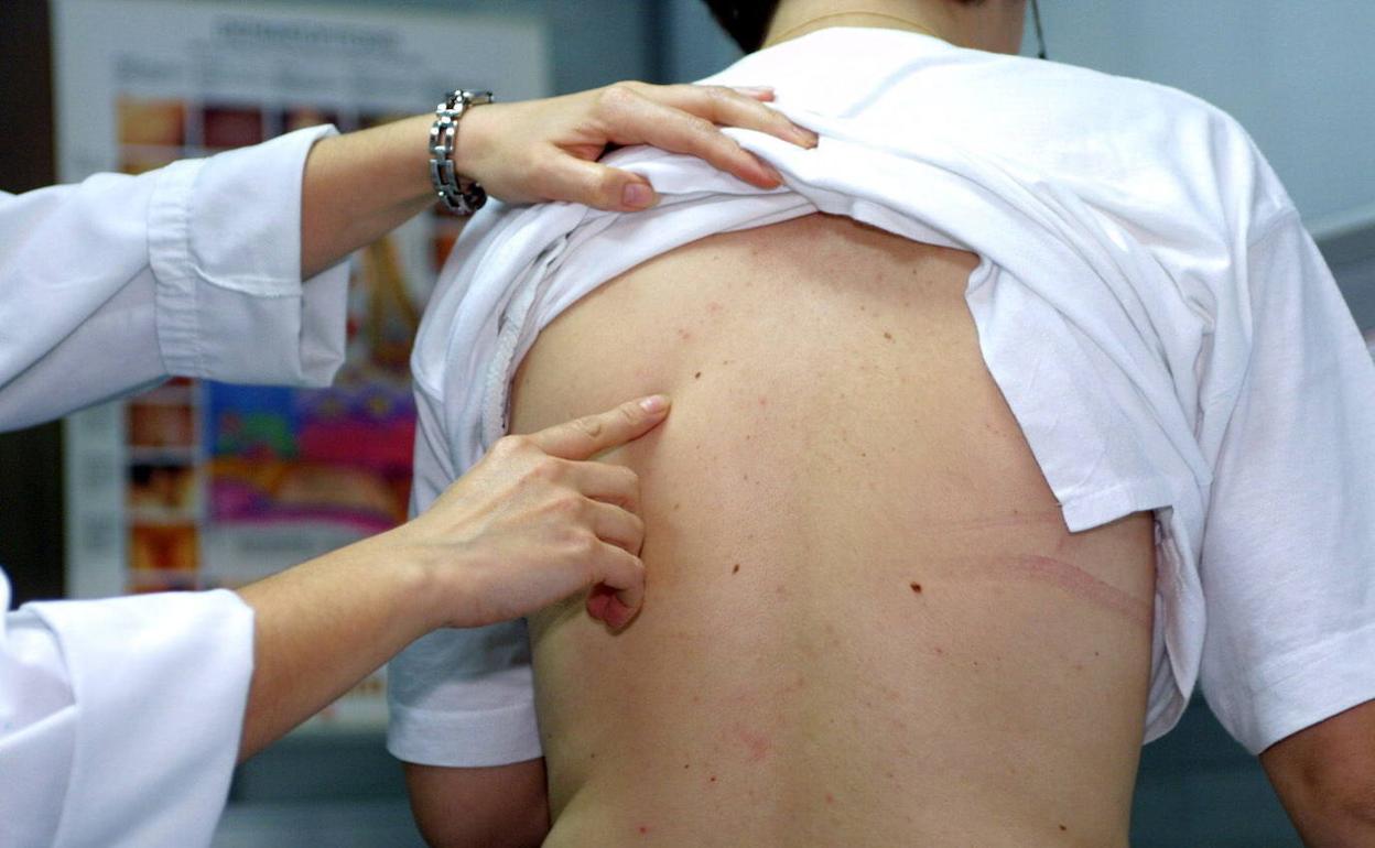 Un dermatólogo explora los lunares en la piel de un paciente durante una revisión.