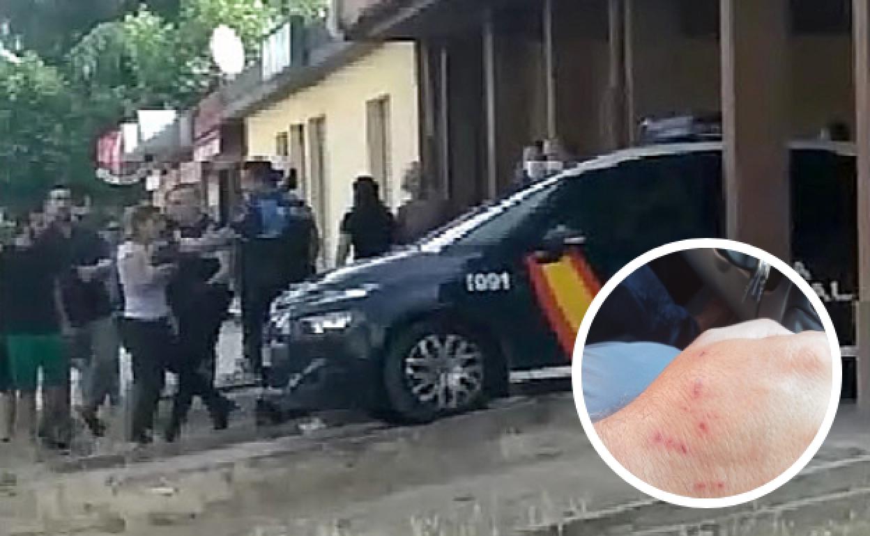 Momento de la detención de las menores y detalle de las lesiones en una mano del hombre que medió para frenar la agresión al niño. 