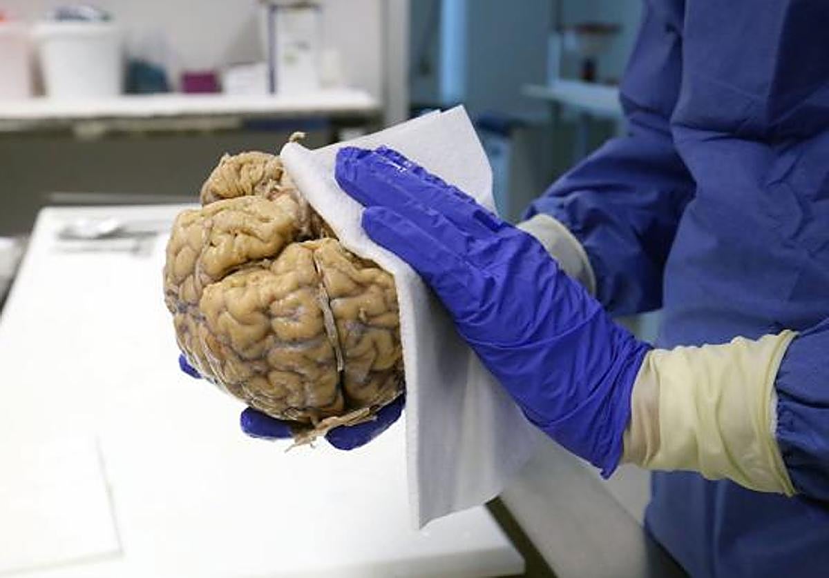 Una investigadora limpia un cerebro donado al banco del hospital valenciano de La Fé.