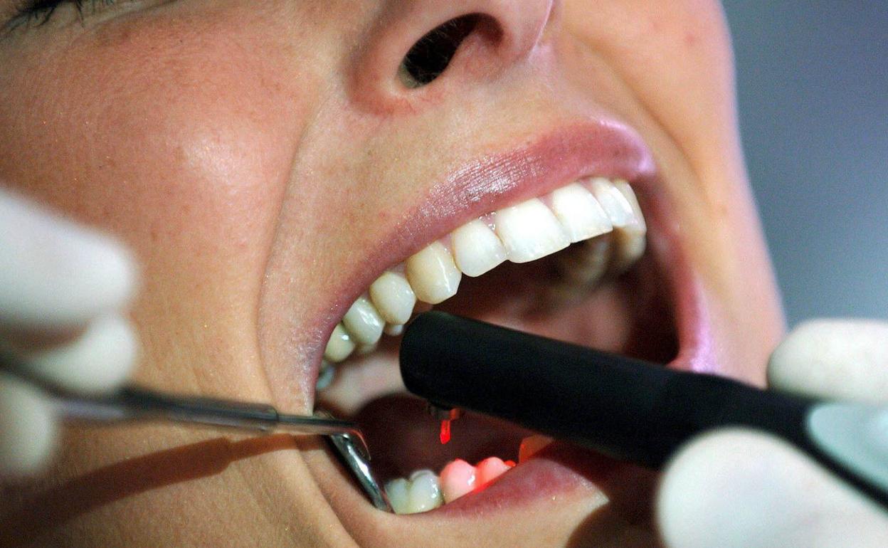 Un dentista detecta caries con un rayo láser.