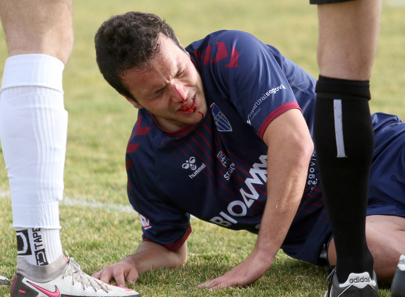 Óscar de Frutos, con sangre en el rostro tras una disputa.