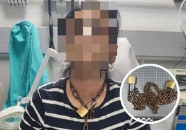 La mujer fue trasladada al Hospital de Miranda aún con la cadena al cuello.