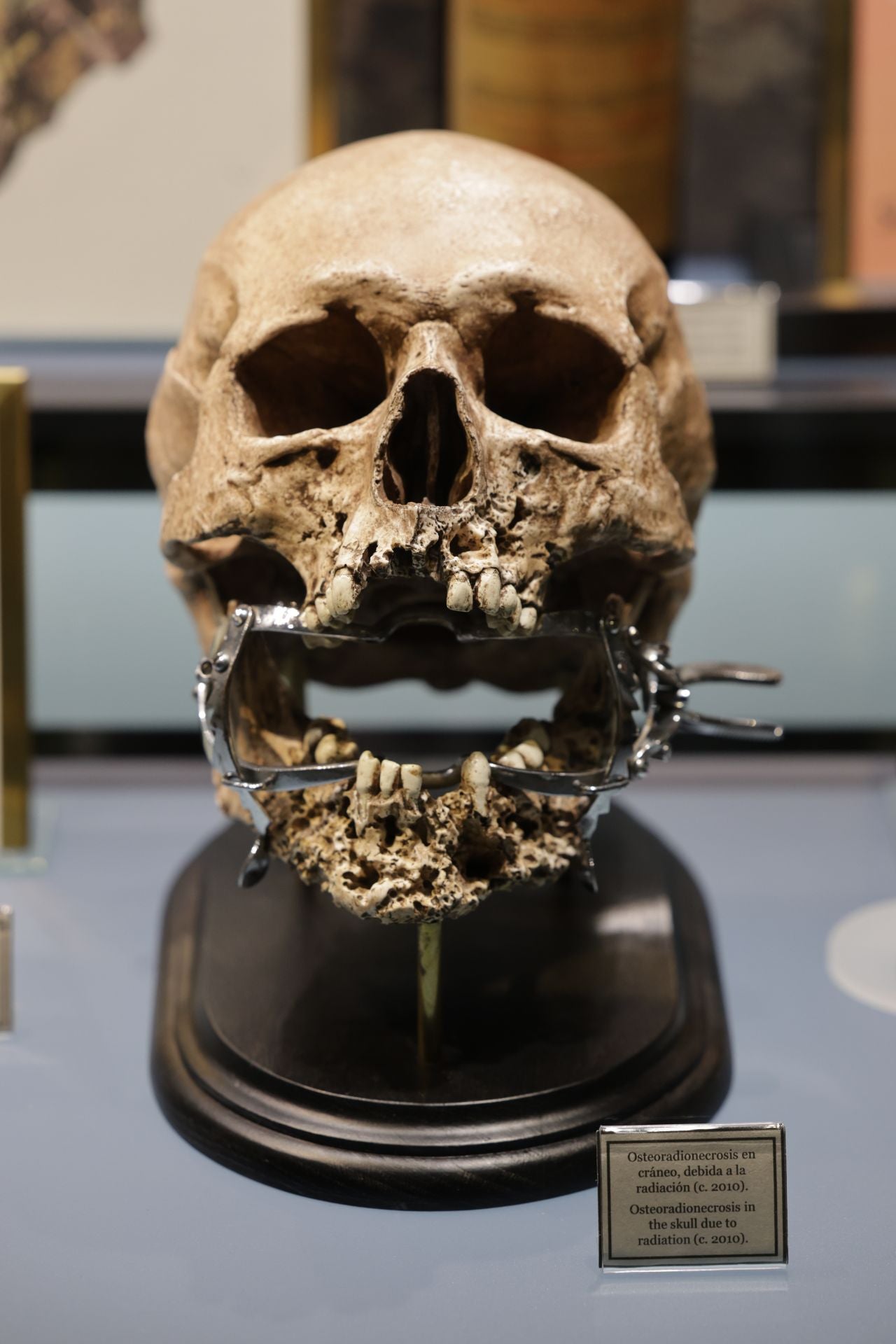 Exposición sobre venenos en el Museo de la Ciencia de Valladolid
