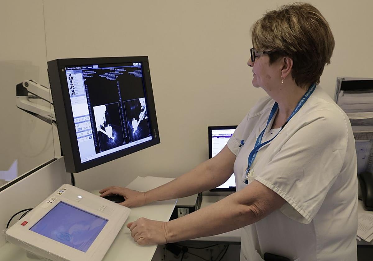 Un software basado en IA ayudará al diagnóstico de mamografías