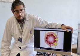 Ricardo Sánchez-Escribano, oncólogo del Hospital Clínico Universitario de Valladolid, especializado en tumores urogenitales.