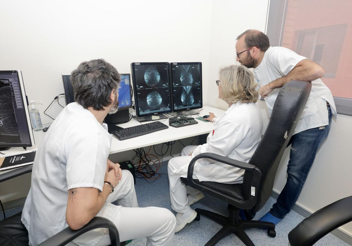 Sacyl externaliza de nuevo la doble lectura de mamografías para agilizar los tiempos del cribado