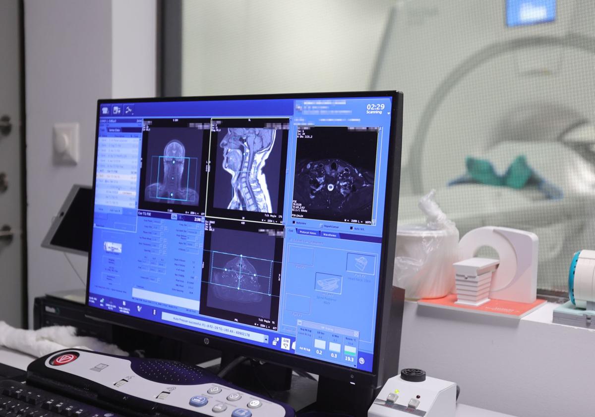 Máquina de resonancia magnética de un hospital de Palencia (Castilla y León).