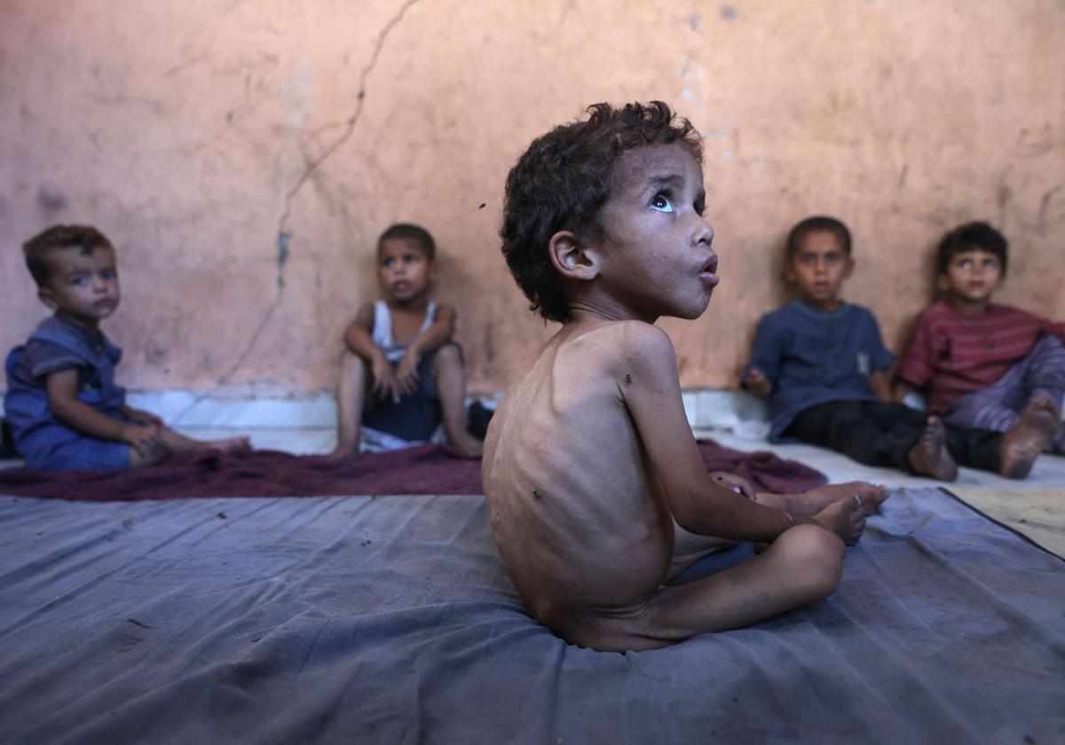 Un niño palestino desnutrido de 2 años, se sienta con sus hermanos en el campo de refugiados de Al-Shati, al oeste de Gaza,