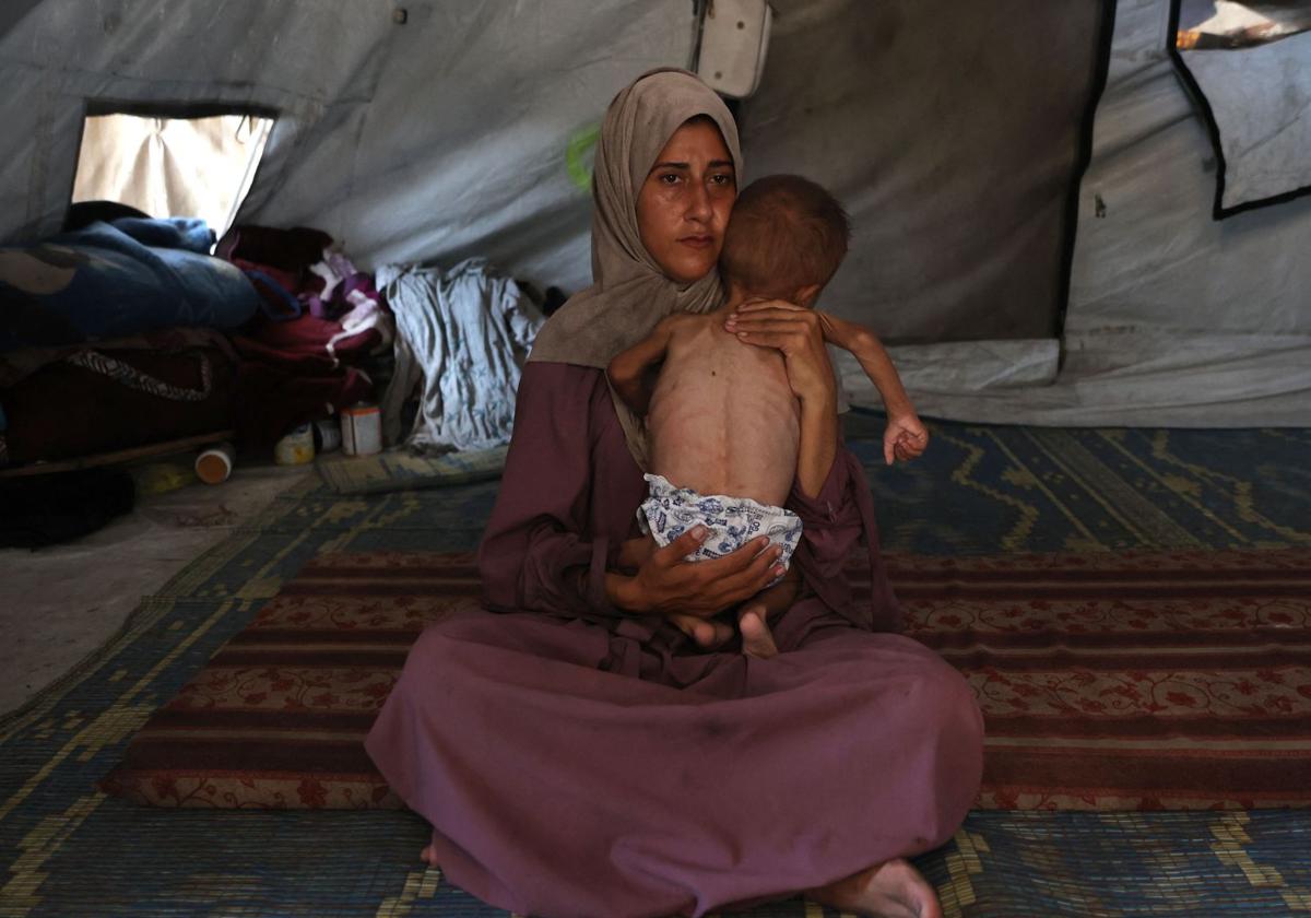 Una madre palestina acuna a su hijo enfermo que muestra signos de desnutrición.