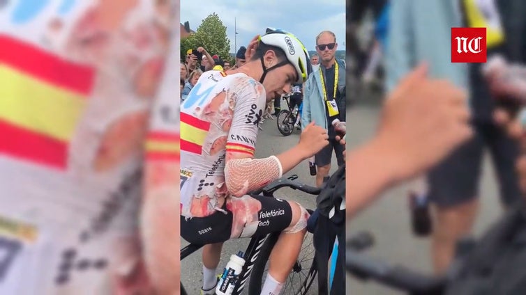 Las primeras imágenes de Iván Romeo tras su caída en el Tour de Francia