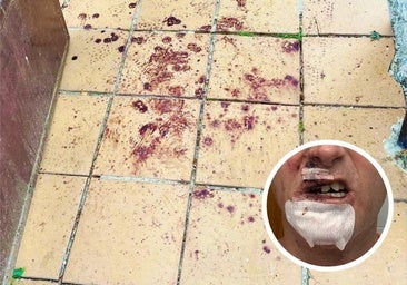 «Estaban orinando delante de mi casa, se lo reproché y me rompieron los dientes»