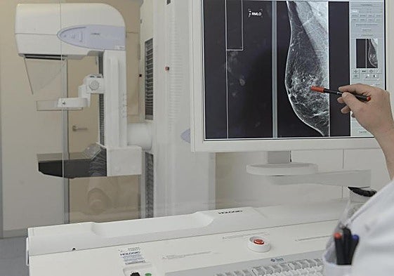Un especialista observa una mamografía.