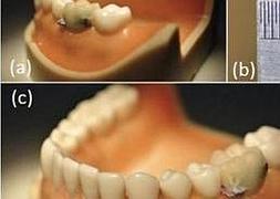 Imagen del prototipo. / Ap