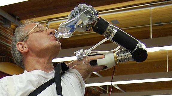 El brazo robótico diseñado por Dean Kamen. 