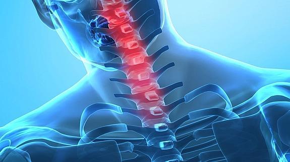 La causa de la escoliosis idiopática podría ser neurológica