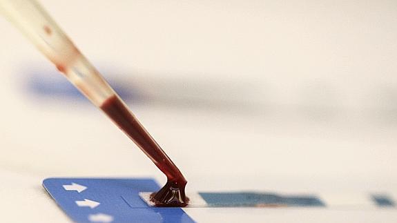 Una enfermera recoge una muestra de sangre durante una prueba del VIH. 