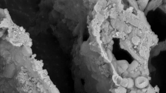 Muestra de microbiota de heces de un individuo sano obtenida mediante microscopio.